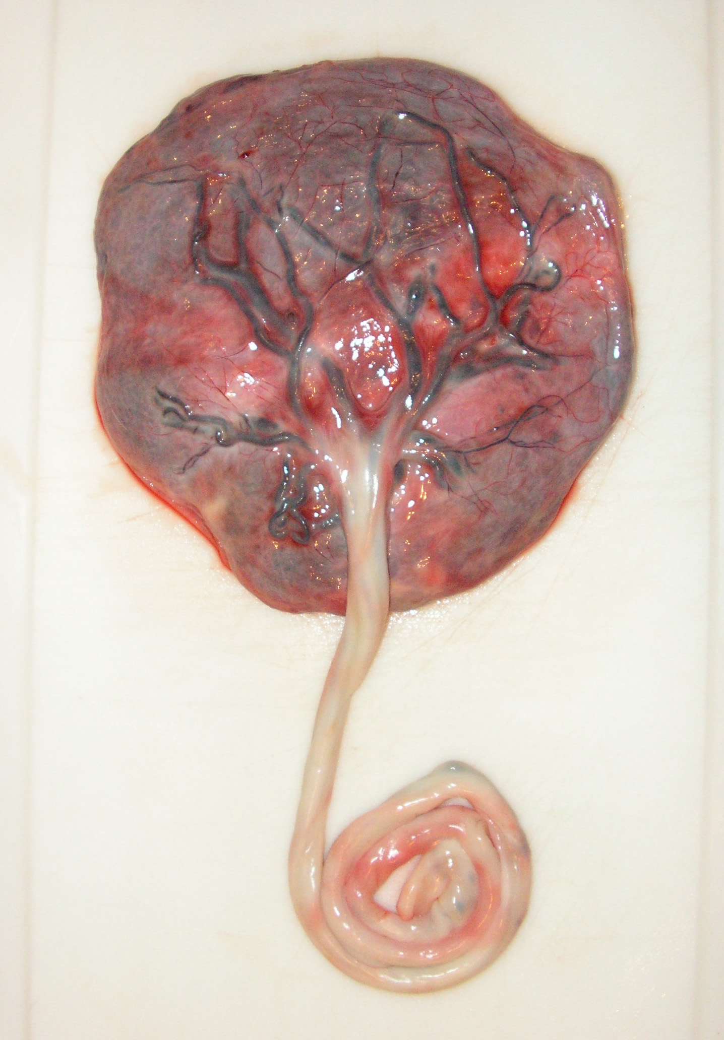 placenta placentas prints tree